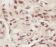 H4 Clustered Histone 1 Antibody - BSA Free