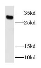 Histone H1T Antibody - BSA Free