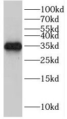 HEY2 Antibody - BSA Free