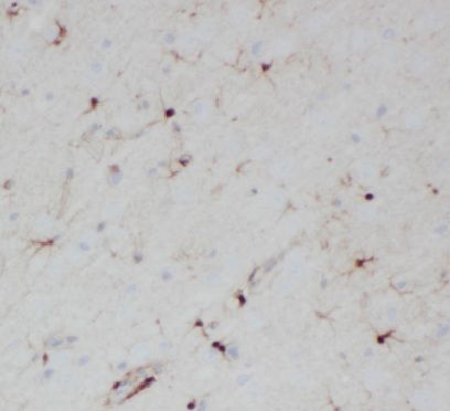HES5 Antibody - BSA Free