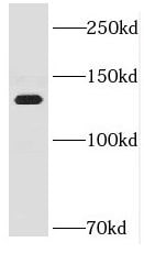 DNA helicase B Antibody - BSA Free