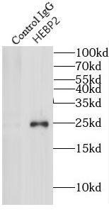 HEBP2 Antibody - BSA Free