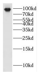 HEATR2 Antibody - BSA Free