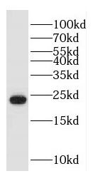 HDDC3 Antibody - BSA Free