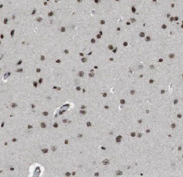 HD domain containing 2 Antibody - BSA Free