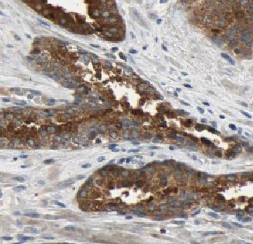 TPD52L1/D53 Antibody - BSA Free