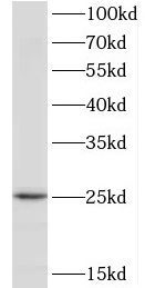 TPD52L1/D53 Antibody - BSA Free