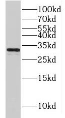HCCS Antibody - BSA Free