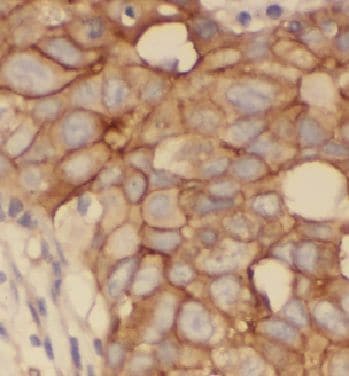 HCCS Antibody - BSA Free