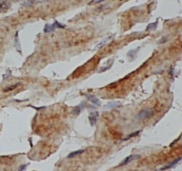Hemoglobin delta Antibody - BSA Free