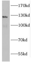GUCY2F Antibody - BSA Free