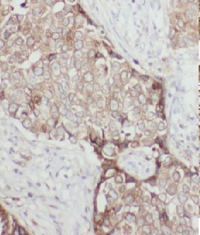 GTPBP3 Antibody - BSA Free