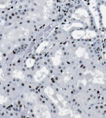 GTF2H5 Antibody - BSA Free