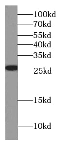 GSTT2B Antibody - BSA Free