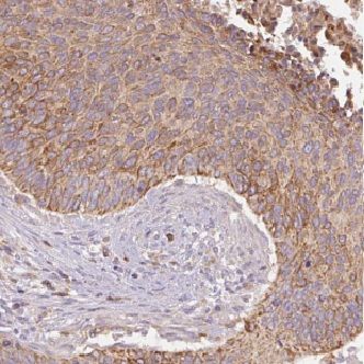 GSTM4 Antibody - BSA Free