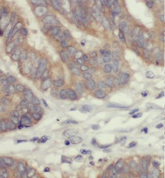 GSPT2 Antibody - BSA Free