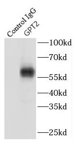GPT2 Antibody - BSA Free