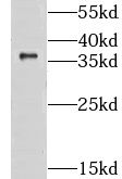 GPS2 Antibody - BSA Free