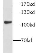 GPRIN1 Antibody - BSA Free