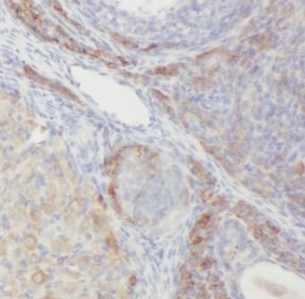 GPR177/WLS Antibody - BSA Free