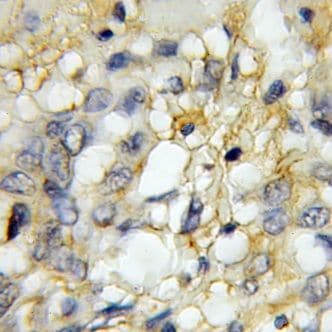 GPR137 Antibody - BSA Free