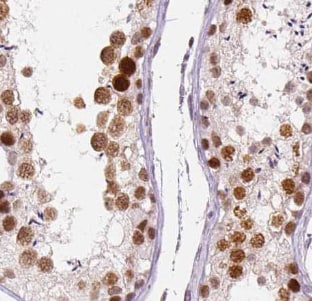 GPR123 Antibody - BSA Free