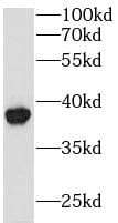 GPD1L Antibody - BSA Free