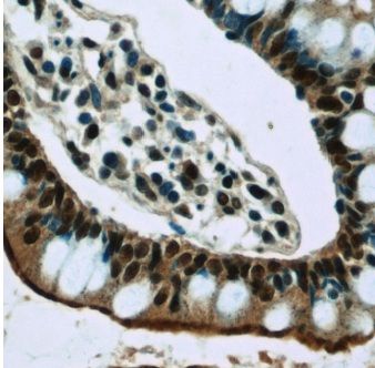 GPBP Antibody - BSA Free