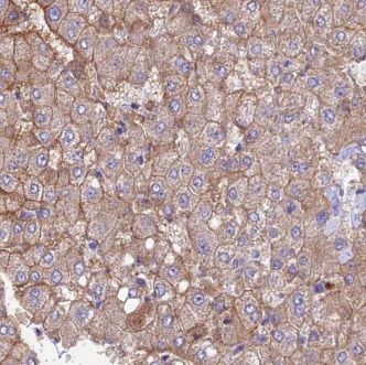 GNPNAT1 Antibody - BSA Free
