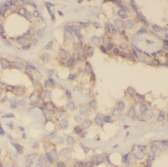 GNPDA2 Antibody - BSA Free