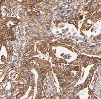 GNPDA1 Antibody - BSA Free