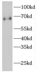 GNPAT Antibody - BSA Free