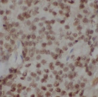 GNL2 Antibody - BSA Free
