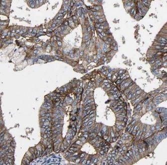 GNB5 Antibody - BSA Free