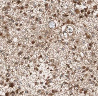 G protein alpha inhibitor 1 Antibody - BSA Free