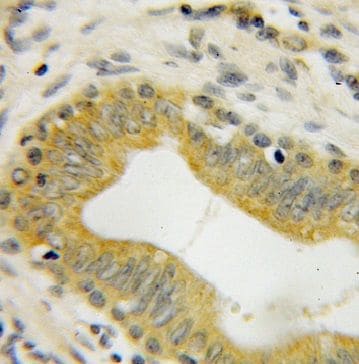GMEB2 Antibody - BSA Free