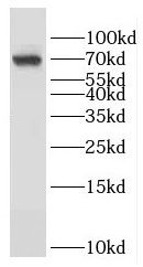 GMEB2 Antibody - BSA Free