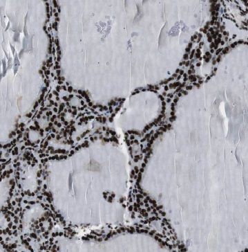 GMCL1 Antibody - BSA Free