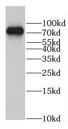GLT25D1 Antibody - BSA Free