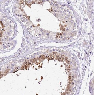 GLIPR1L1 Antibody - BSA Free