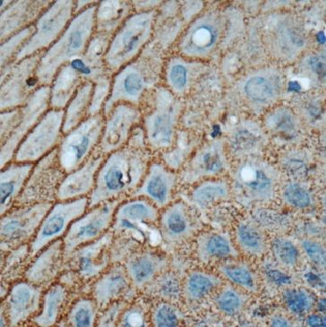 Connexin 31/GJB3 Antibody - BSA Free