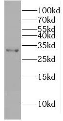 GIYD2 Antibody - BSA Free