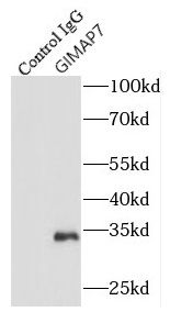 GIMAP7 Antibody - BSA Free