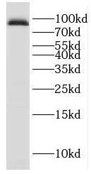 Gamma-Glutamyltransferase 7 Antibody - BSA Free