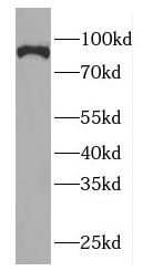 GGCX Antibody - BSA Free