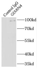 Gemin 4 Antibody - BSA Free