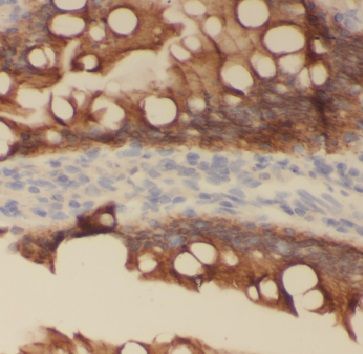 GCS1 Antibody - BSA Free