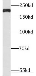 TUBGCP6 Antibody - BSA Free