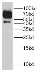 MYOZAP Antibody - BSA Free
