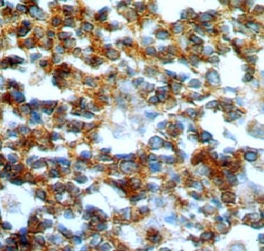 GCNT2 Antibody - BSA Free